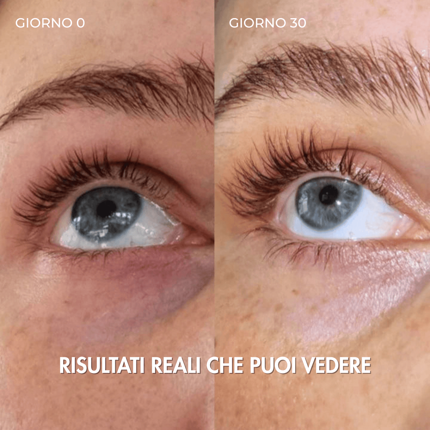 Confronto prima e dopo 30 giorni di utilizzo del siero LURIA con ciglia più lunghe e definite