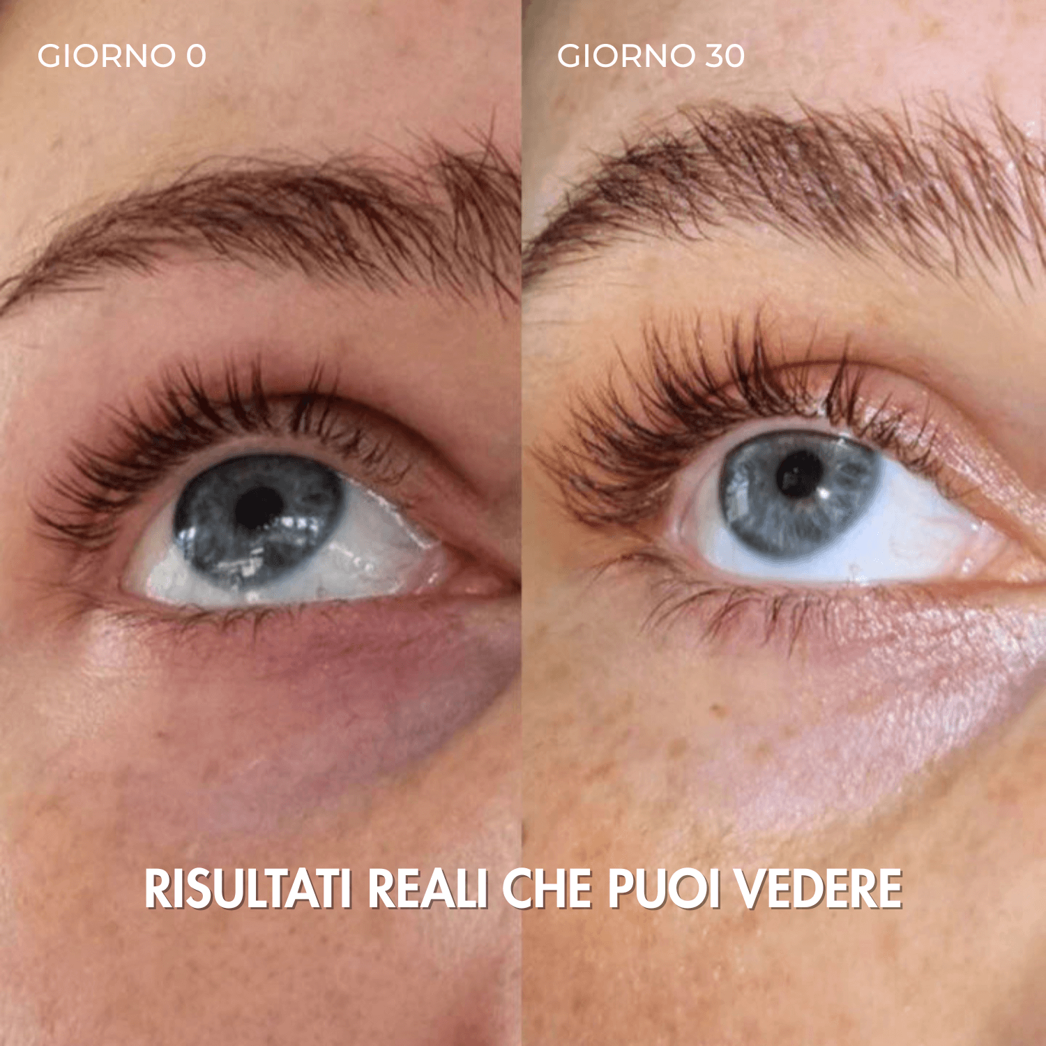Confronto prima e dopo 30 giorni di utilizzo del siero LURIA con ciglia più lunghe e definite